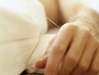 Miami Acupuncture Clinic