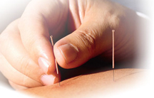 Acupuncture For Miami